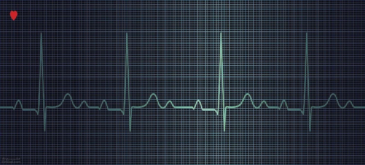 تشخیص مشکلات قلبی با استفاده از هوش مصنوعی